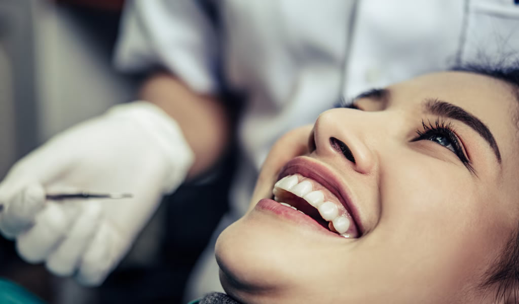 The Benefits of Dental Veneers